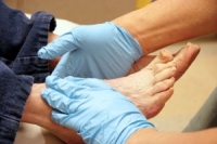 Frequent Foot Exams are Necessary for Diabetic Patients